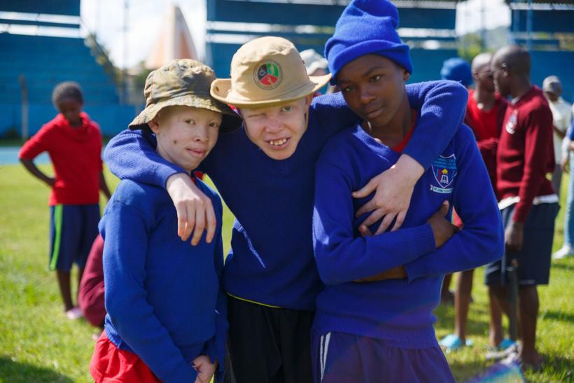 A learner with albinism at work in a classroom.