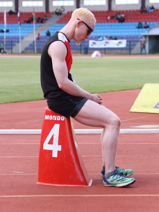 An athlete with albinism in sunglasses on a running track.