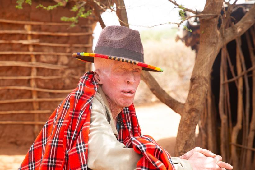An elder with albinism in a wide-brim hat and a red shuka.