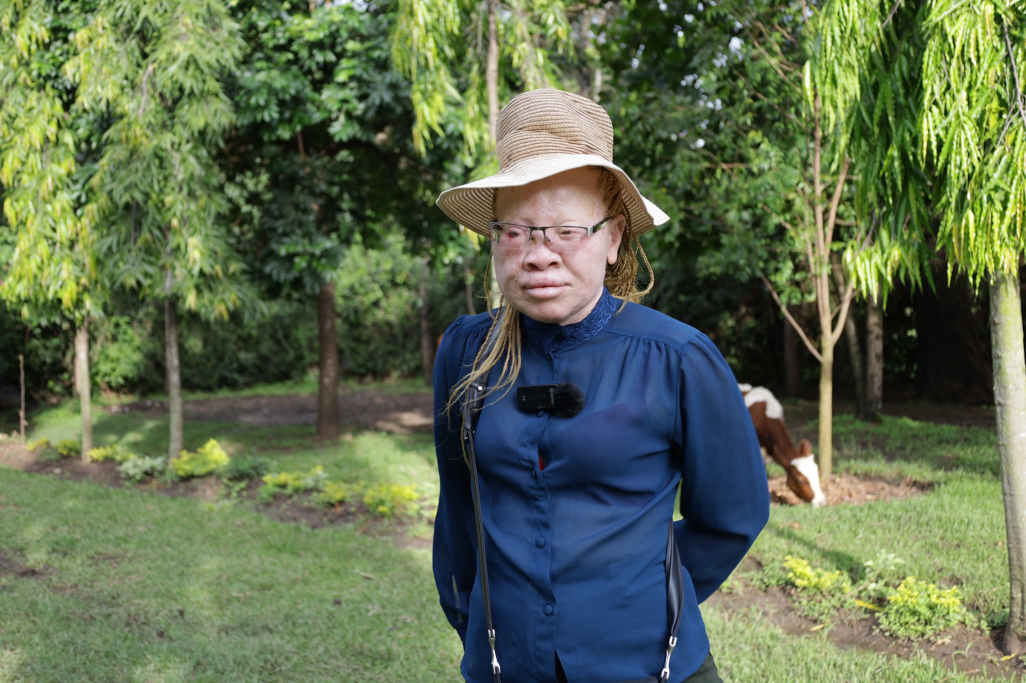 Elizabeth Atieno, Kisumu County at Black Albinism