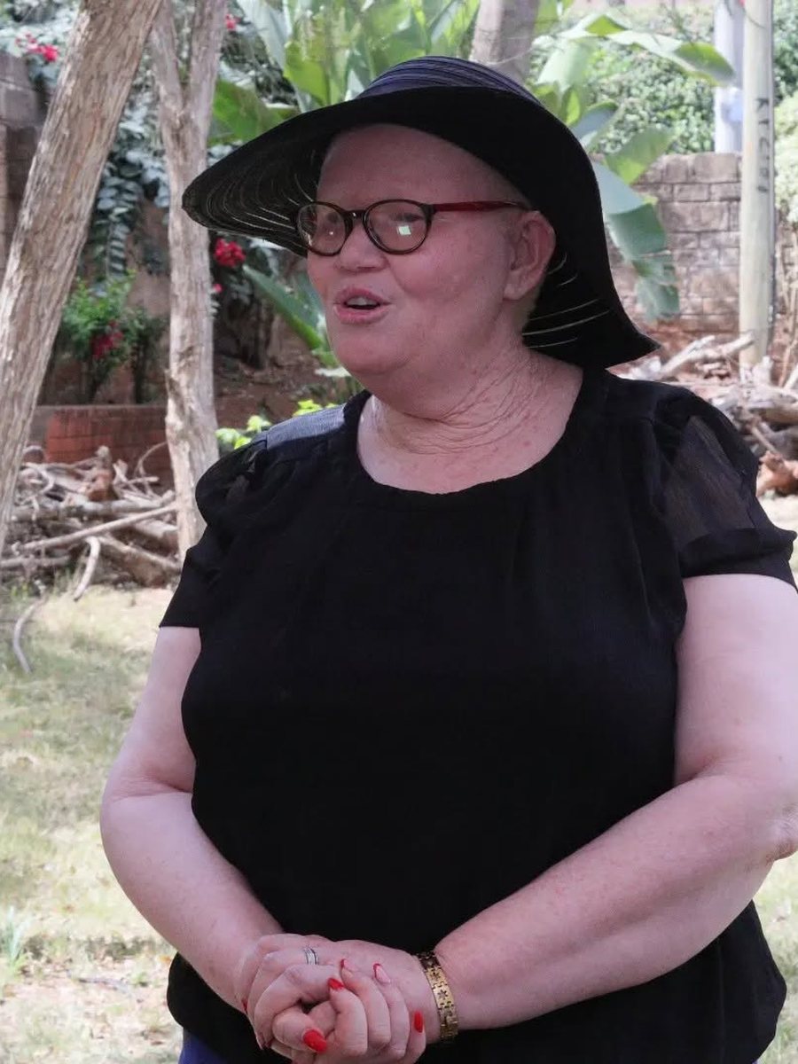 Jeriter Mutinda, Machakos County at Black Albinism.