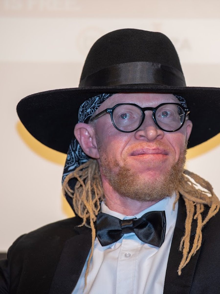 Stephen Wafula, Board Chair at Black Albinism.